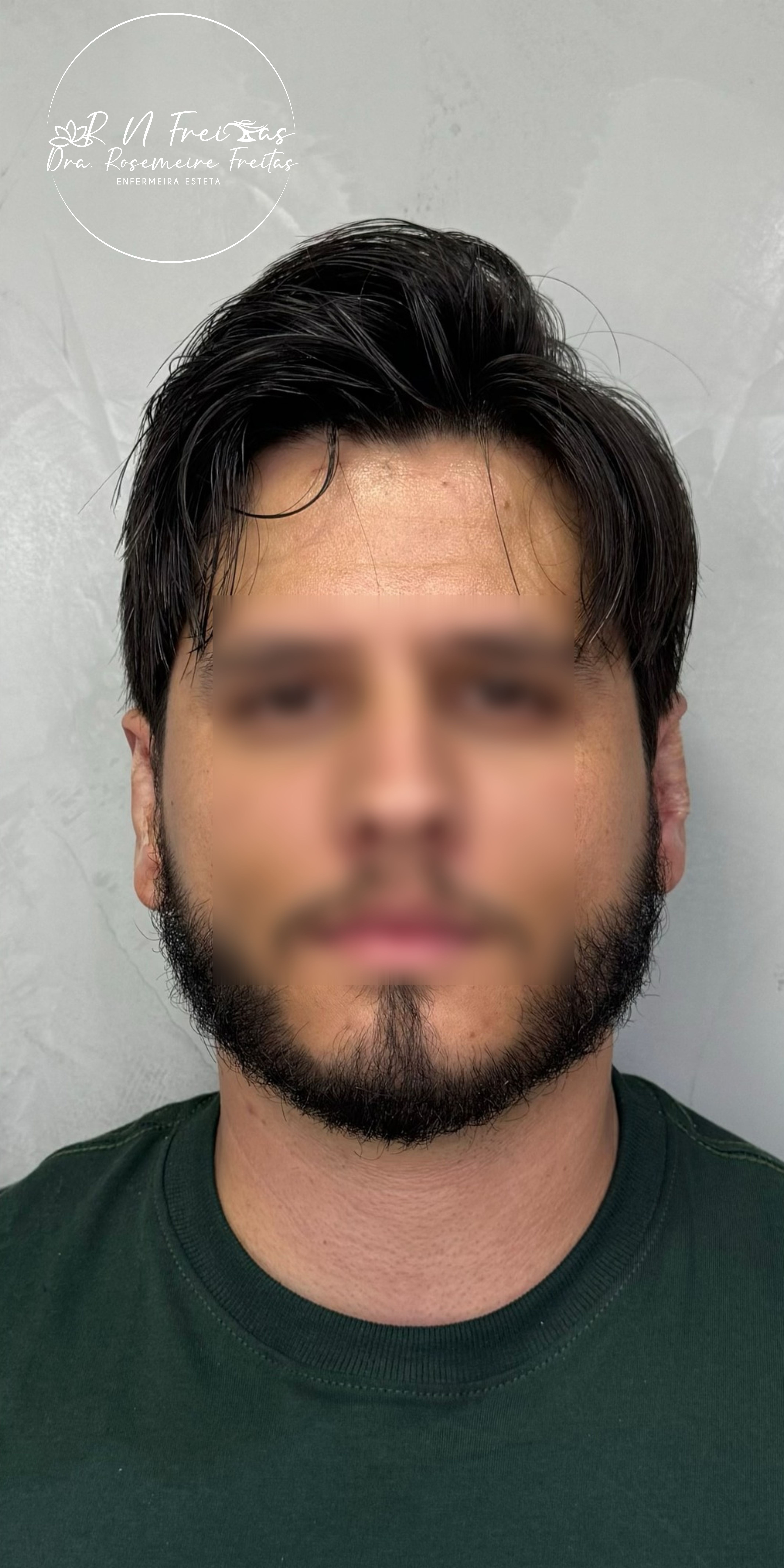 Depois do tratamento